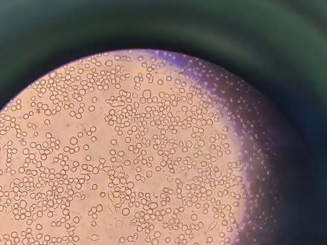 小胶质细胞形态是否是静息态