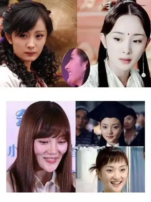 最惨的六大明星整容失败!杨幂郑爽