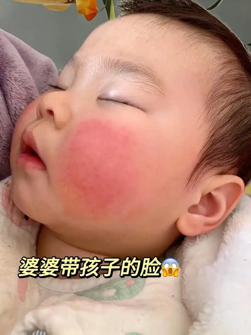 妈妈们必看~宝宝红脸蛋还得靠它!冬天来了~快给孩子们安排小浣 - 抖音