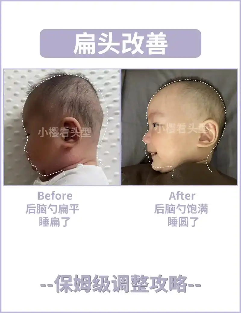 创作灵感 保姆级扁头调整经验总结6015帮宝宝睡圆头73#宝宝头