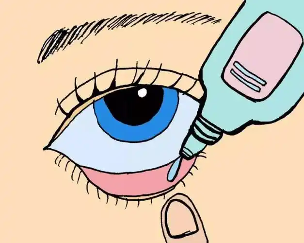 眼睑,暴露下方结膜囊(俗称"白眼珠"),把约1厘米长的眼膏涂入结膜囊内