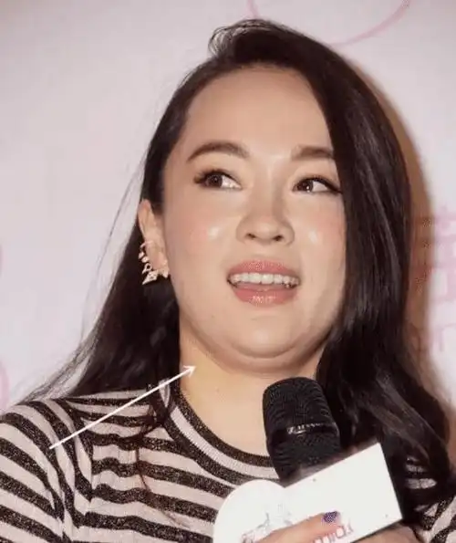 怀孕后胖得离谱的女明星有人飙升55斤有人直逼190胖若两人