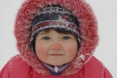 宝宝的脸蛋容易出现发红,样子会看起来很可爱,但很多家长往往会忽视