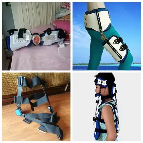 哪里的假肢好假肢马鞍山德康假肢公司查看