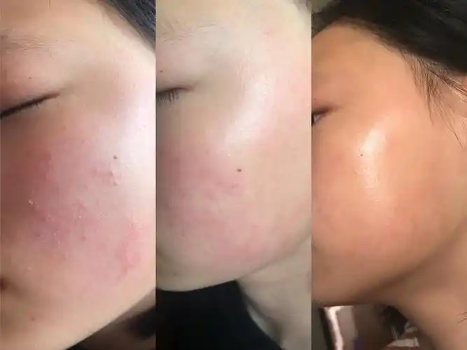 肌底角质修复精华修护受损肌底强韧肌肤屏障补水保湿抗氧化增强皮肤