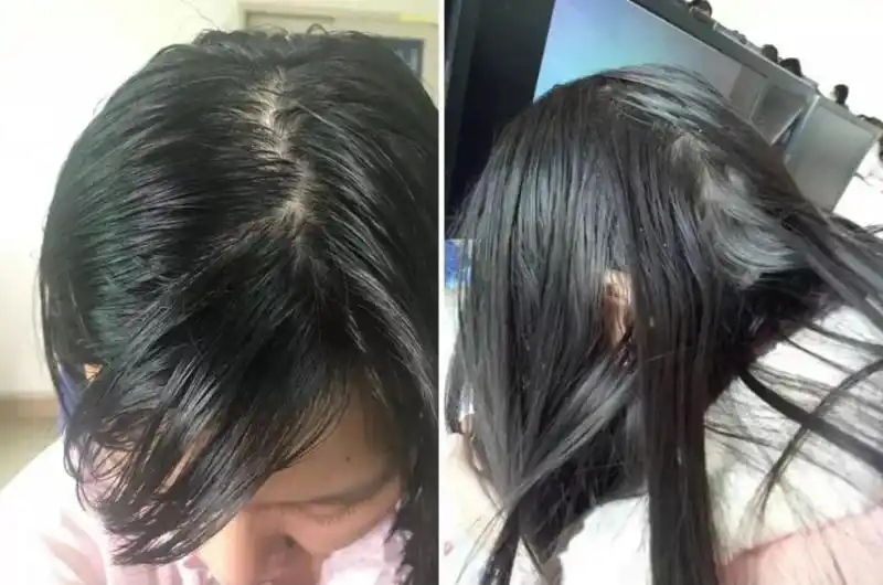 小娟从不觉得,头发打绺了,看起来很丑.