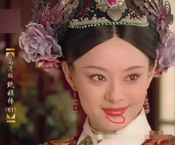 郑爽晒自拍嘴角疤痕抢镜 孙俪下巴有痣 小残缺才造就真美女