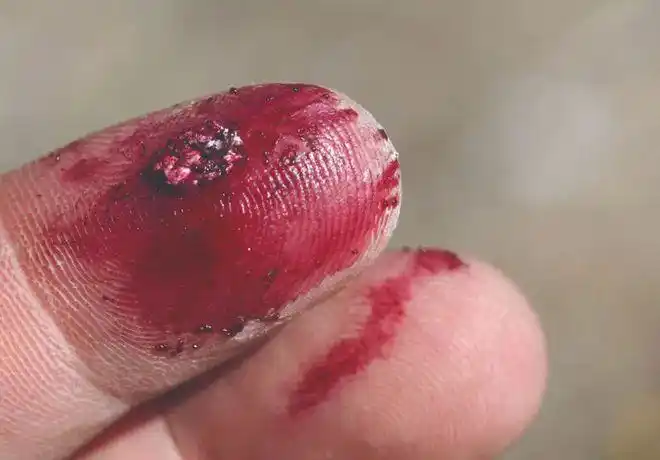 影视剧里的流血伤口是怎么来的