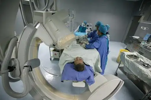 心脏支架手术:被神化,还是被妖魔化?(1)_光明视点_光明网(组图