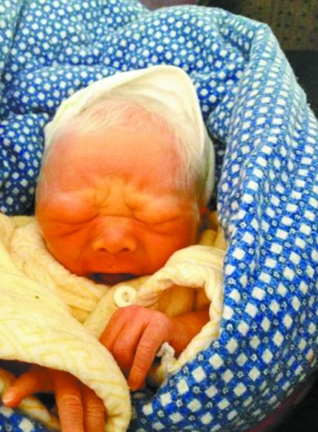 白发女婴在路边被捡到,害怕宝宝又病,结果却是喜从天降