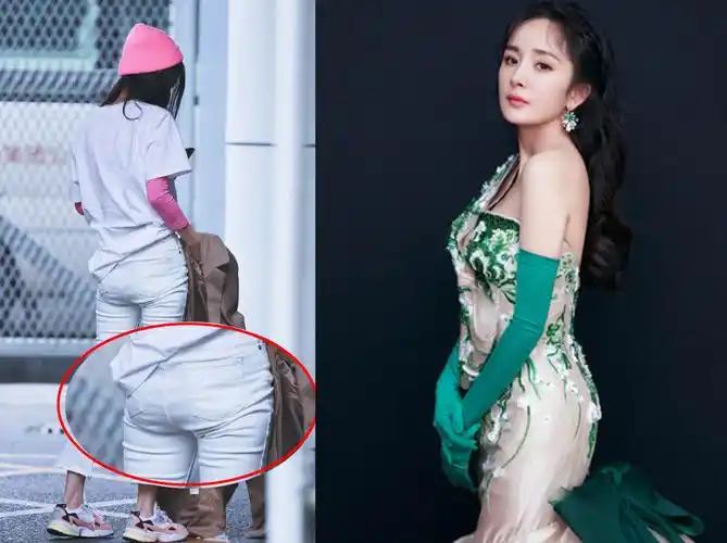 杨幂久坐致蜜桃臀塌陷脚踝被蚊虫叮咬坦言不杀生