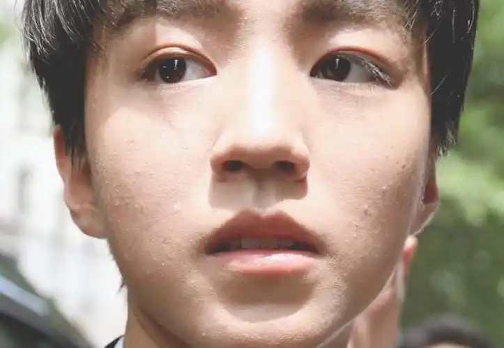 粉底也遮不住王俊凯的粉刺和痘痘,粉丝:化妆师能不能用点心