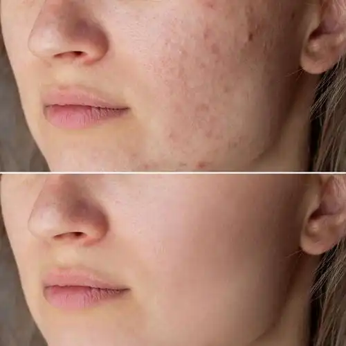 敏感肌闭口修复不翻车恐怕你真的离不开它了