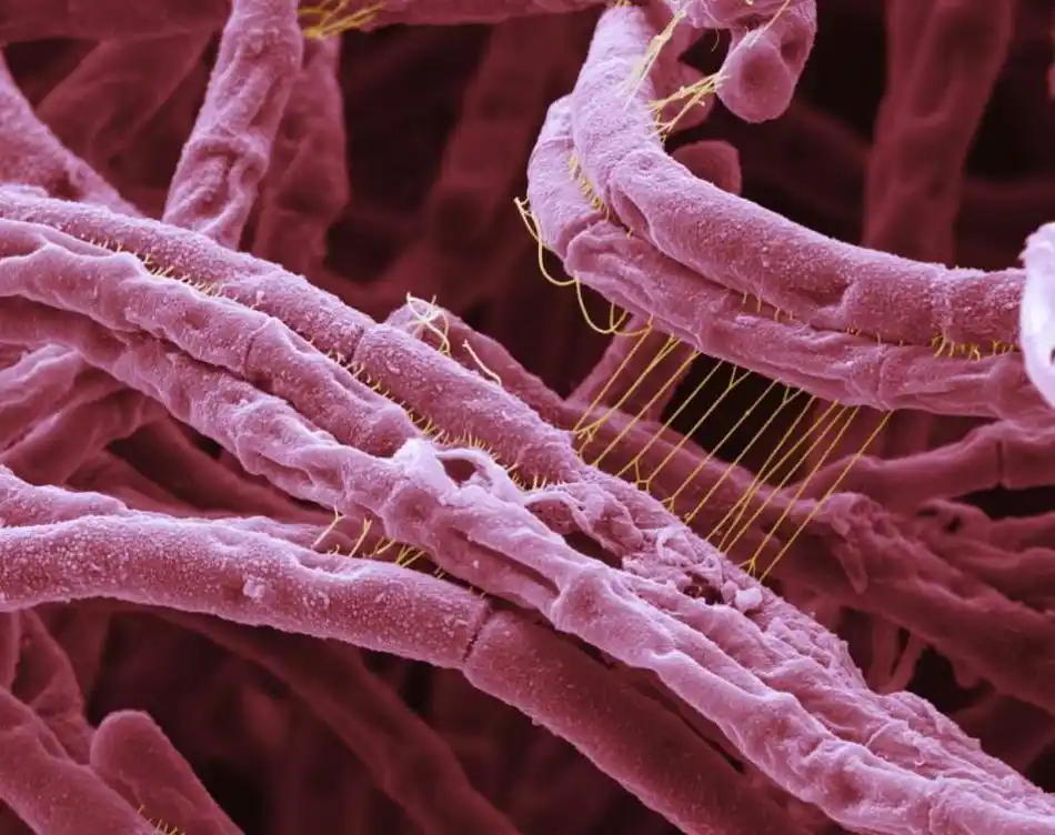 显微镜展致命细菌真面目:sars病毒可刺透宿主细胞-科教台-中国网络