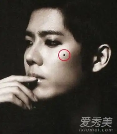 痣相图解:你身上是否长有破财痣