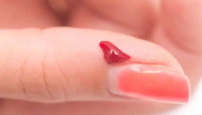 梦见别人身上有血是什么意思--解梦境-周公解梦,十二