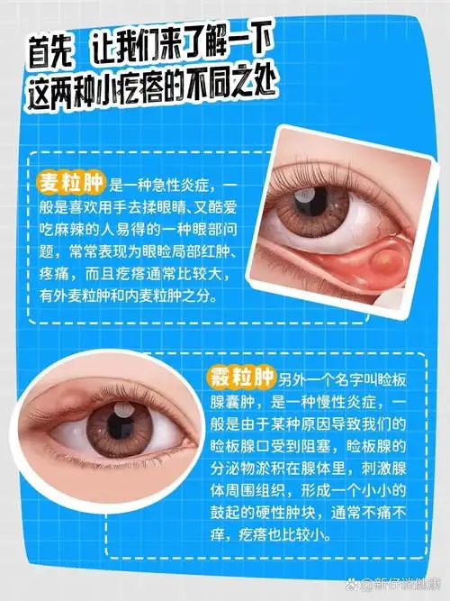 那些长在我们眼部的小疙瘩究竟是什么呢?