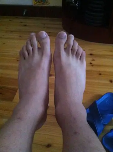 我脚掌这个样子有没有什么问题,骨头形状有没有问题_百度知道