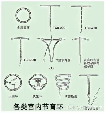 绝经后被遗忘在身体里的节育环可能是一颗定时炸弹