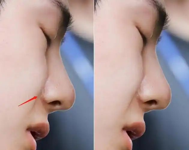 王一博|王一博别演戏了!整容痕迹暴露于镜头之下