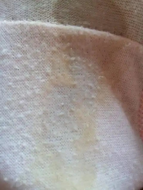 白带每天都这样正常吗.