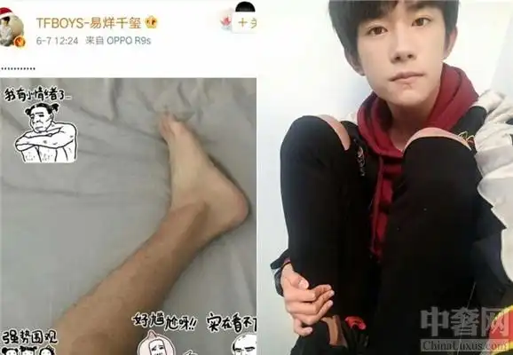 易烊千玺晒腿毛照片 清奇的画风谁人能懂