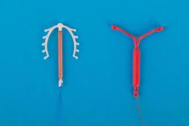 10年未取环,它穿透子宫到了别处……    "上环"是女性常用的避孕方式