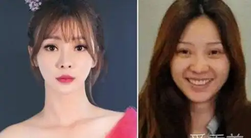 柳岩整容前后照片对比图素颜能吓死人
