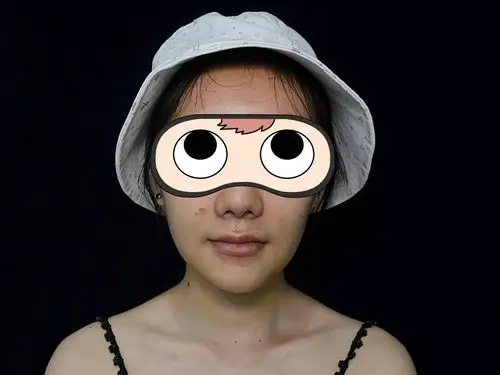 一直对自己的下巴不太满意,有些人适合w下巴,而且也_圈子-新氧美容