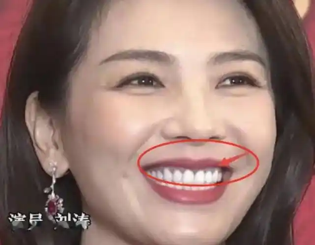 刘涛为了保持良好的牙齿状态,经常前往牙科医院进行修复.