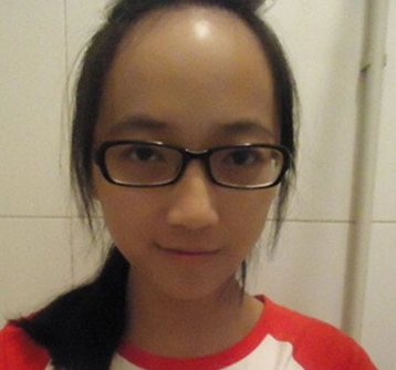 我发一张图,这种才算发际线高的.