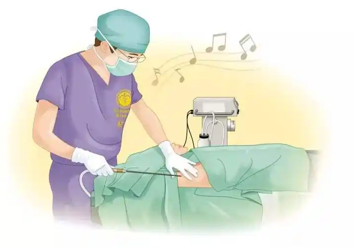 ③手术治疗安排!这个其实很简单直接,大汗腺你出汗对吧?