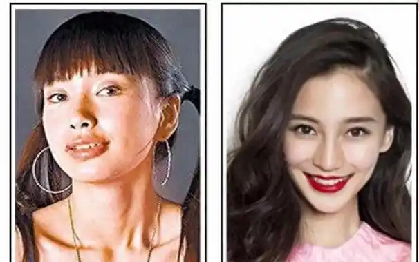 不过杨颖本人回应,她只是拔了智齿,其它的并没有做改变,以前的照片是