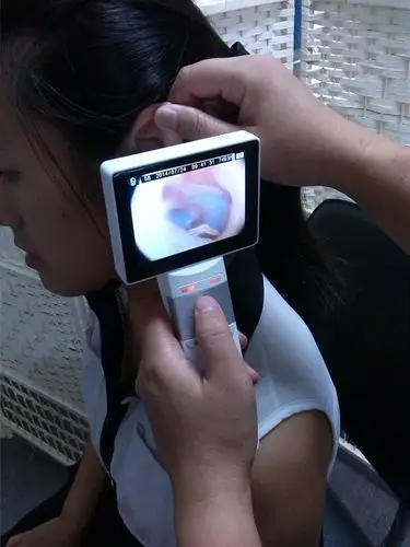 便携式电子五官镜便携皮肤镜和一般镜头自带usb输出接口