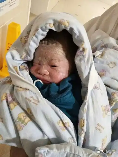 各位宝妈们你家的宝宝刚出生是不是很丑?后来变好看了吗?