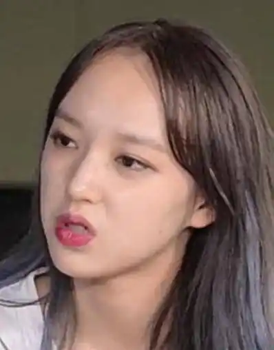 程潇未p照曝光,才20岁满脸的小疙瘩,这一对比欧阳娜娜是美女!