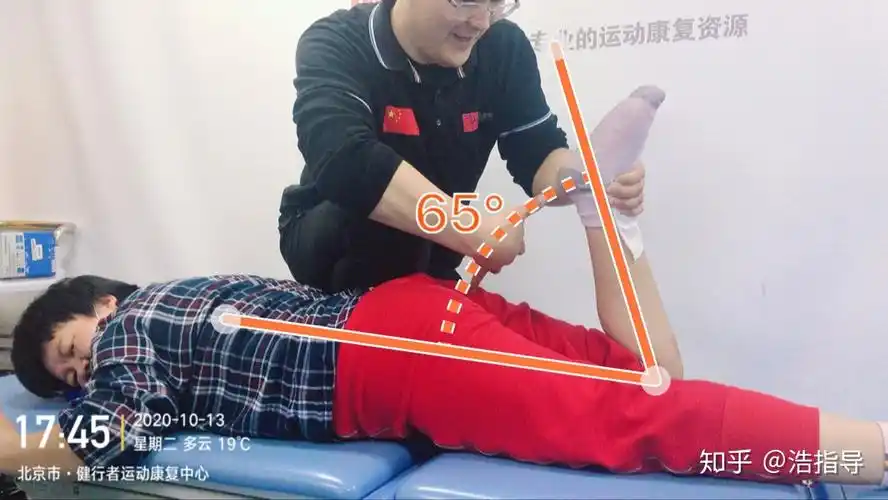 康复故事103松解术后20天每天掰腿最差100多度找我第一次康复才90度她