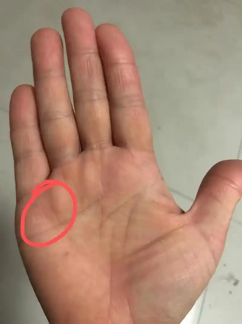 肾 气不足,生命线出现了断裂,还好有一条副线, 手诊知健康, - 抖音