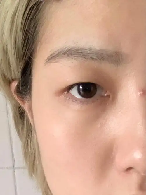 肿内双06615失败6015新手不会贴双眼皮贴进来学