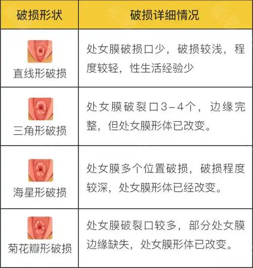 修补处女膜可以去专业的医院做修补手术,这个根据自身情况判断是否