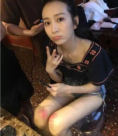 伤口_包贝尔_时候