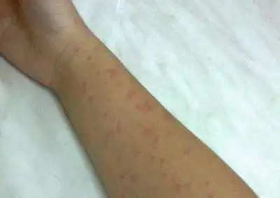 水果店为销量狂蹭热点,居然卖"好吃不分手,吃了抗过敏"芒果?