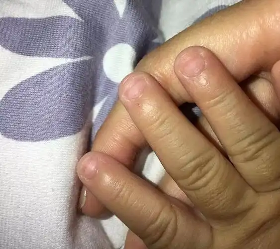 原创宝宝指甲出现这些特征,说明疾病要"找上门"了,妈妈们别忽视