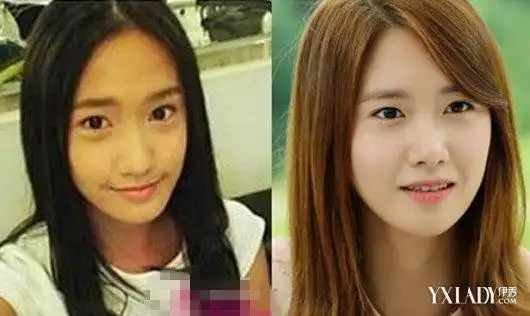 《武神赵子龙》热播 林允儿整容前后照片遭曝光