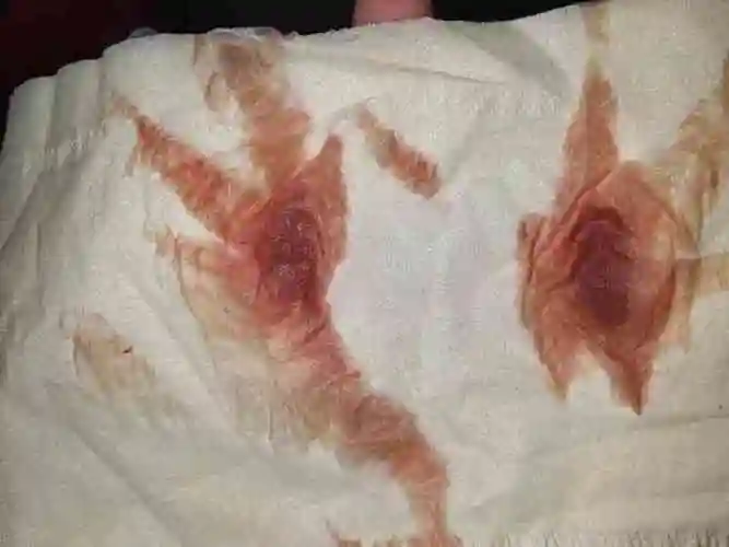 也并不一定是怀孕的征兆,受精卵着床一般都是发生在受精6天之后,出血