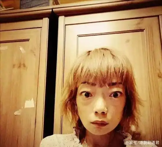 病情恶化即将大手术!"永安太子爷"41岁前妻被曝割胃后大肠阻塞