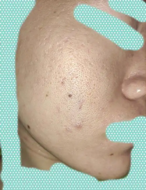 有见过这么粗糙的脸么?因为脸,真的抑郁!(慎入)