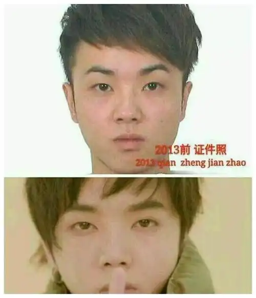 华晨宇因面部变化再被质疑整容粉丝回击整容不可怕谁丑谁尴尬