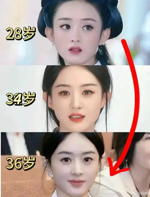 那些宣称我丽颖整了容的人,好好睁大你们的眼睛看看这几张照片!