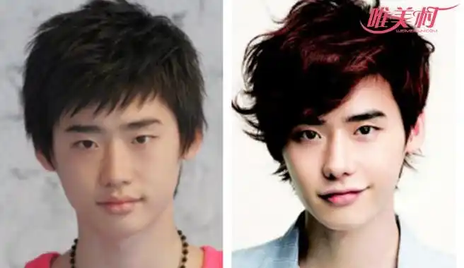 李钟硕承认整容后照片对比 细节处有不少变化